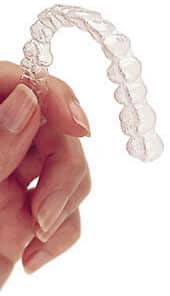 Invisalign Orlando Florida